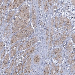 PAPSS1 Antibody, Novus Biologicals 25ul | Buy Online | Novus Biologicals | Fisher Scientific